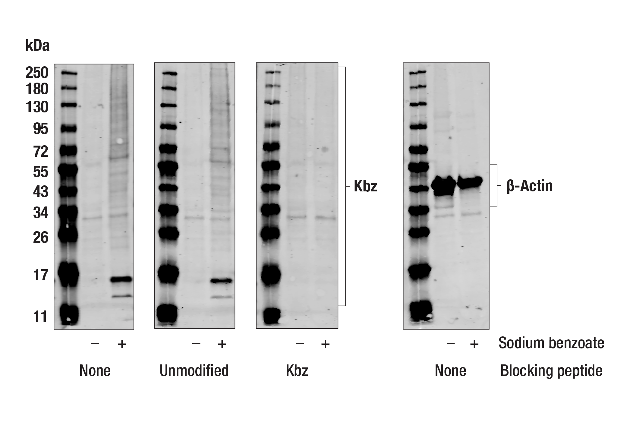 S.D.S. SDS 10インチレコード Benzoyl Lysine (F5U6Z) Rabbit mAb | Cell Signaling Technology