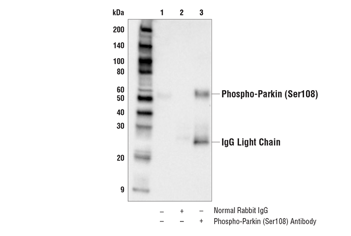 Immunoprecipitation Image 1: Phospho-Parkin (Ser108) Antibody