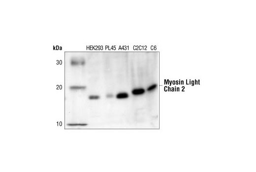 Western Blotting Image 1: Myosin Light Chain 2 Antibody
