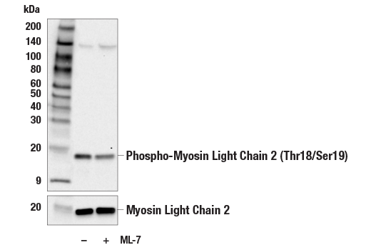 Western Blotting Image 1: Phospho-Myosin Light Chain 2 (Thr18/Ser19) Antibody