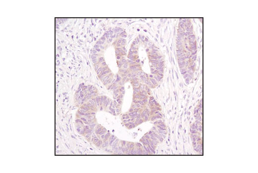  Image 30: Adipogenesis Marker Antibody Sampler Kit