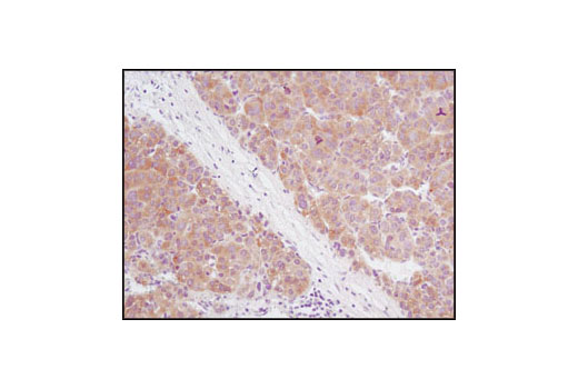 Immunohistochemistry Image 4: Acetyl-CoA Carboxylase (C83B10) Rabbit mAb
