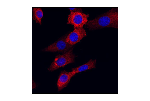Immunofluorescence Image 1: Acetyl-CoA Carboxylase (C83B10) Rabbit mAb