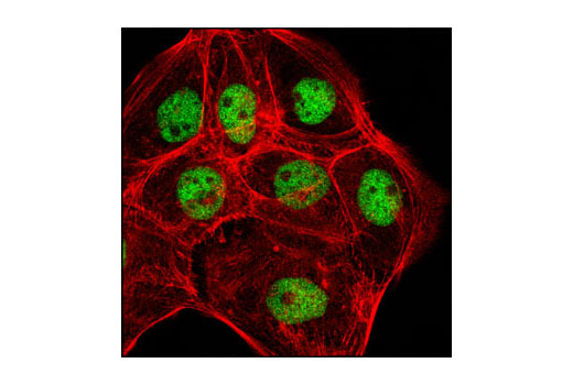 Immunofluorescence Image 1: MSK2 (D41A4) XP® Rabbit mAb