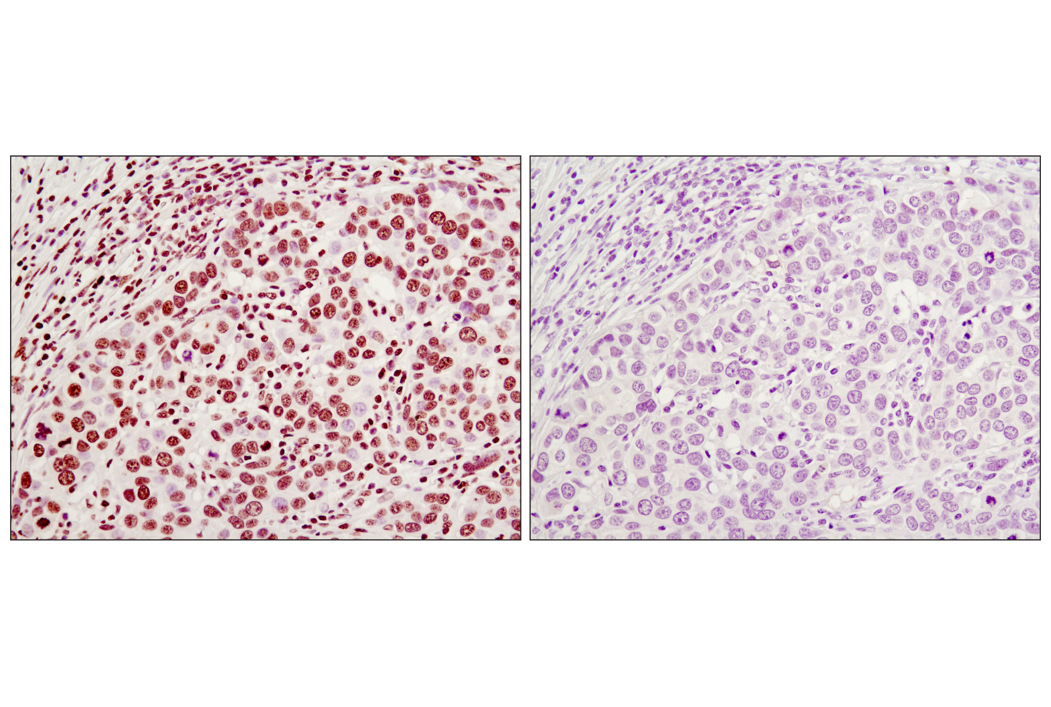 Immunohistochemistry Image 2: Histone H3 (96C10) Mouse mAb (IHC Formulated)