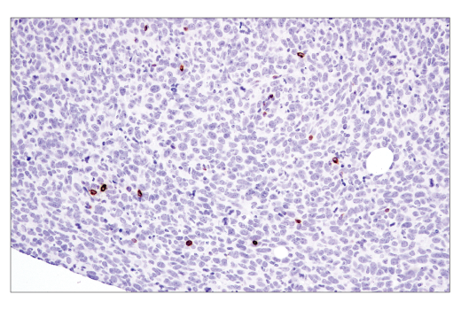 Immunohistochemistry Image 1: Perforin (E3W4I) Rabbit mAb (BSA and Azide Free)