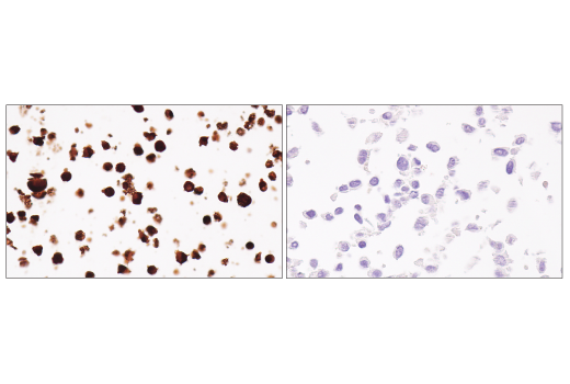 Immunohistochemistry Image 3: Perforin (E3W4I) Rabbit mAb (BSA and Azide Free)