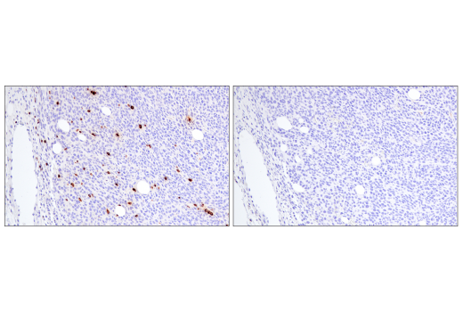 Immunohistochemistry Image 2: Perforin (E3W4I) Rabbit mAb (BSA and Azide Free)