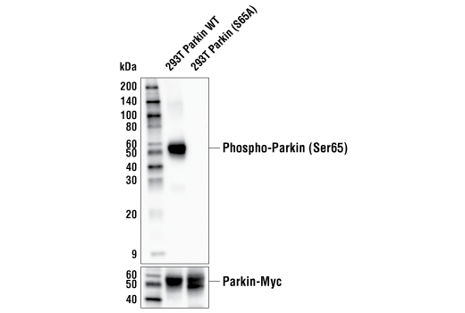 Western Blotting Image 1: Phospho-Parkin (Ser65) Antibody