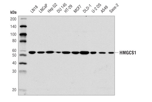 Western Blotting Image 1: HMGCS1 (D5W8F) Rabbit mAb
