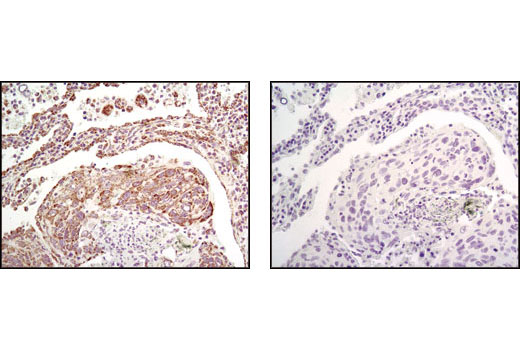 Immunohistochemistry Image 2: Grp75 (D13H4) XP® Rabbit mAb (BSA and Azide Free)
