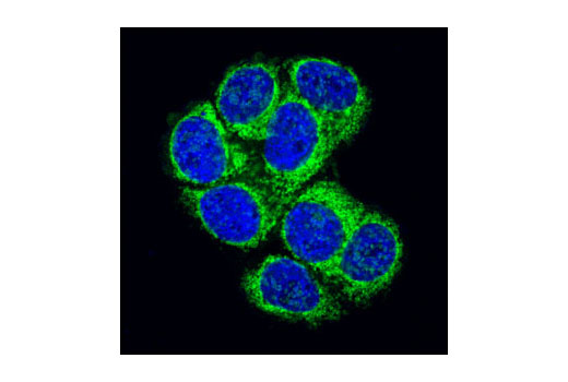 Immunofluorescence Image 1: Hexokinase I (C35C4) Rabbit mAb (Alexa Fluor® 488 Conjugate)
