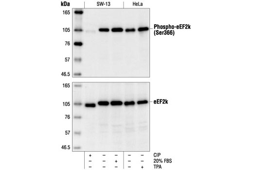 Western Blotting Image 1: Phospho-eEF2k (Ser366) Antibody