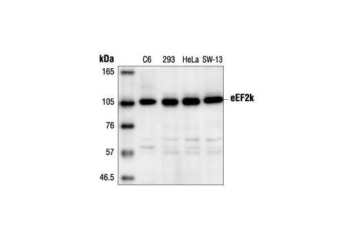 Western Blotting Image 1: eEF2k Antibody