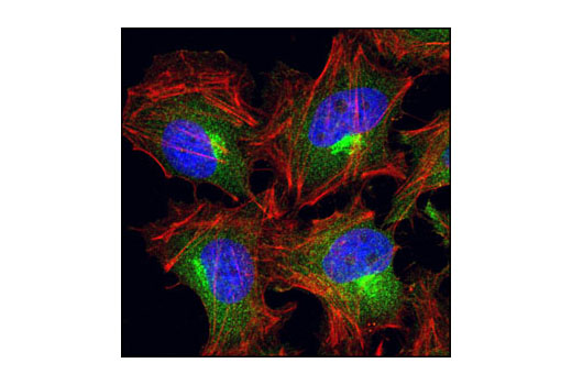 Immunofluorescence Image 1: eEF2k Antibody
