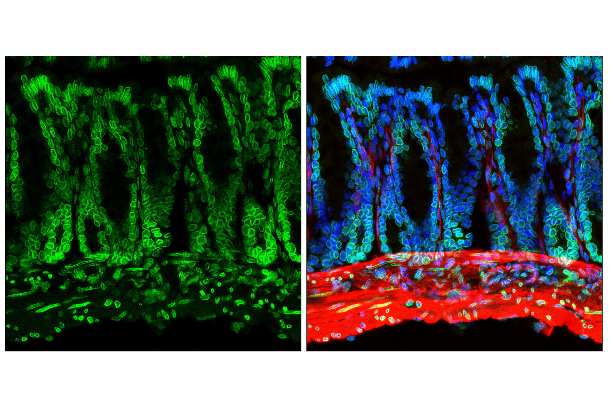 Immunofluorescence Image 1: NUP153 (E3N3Y) Rabbit mAb