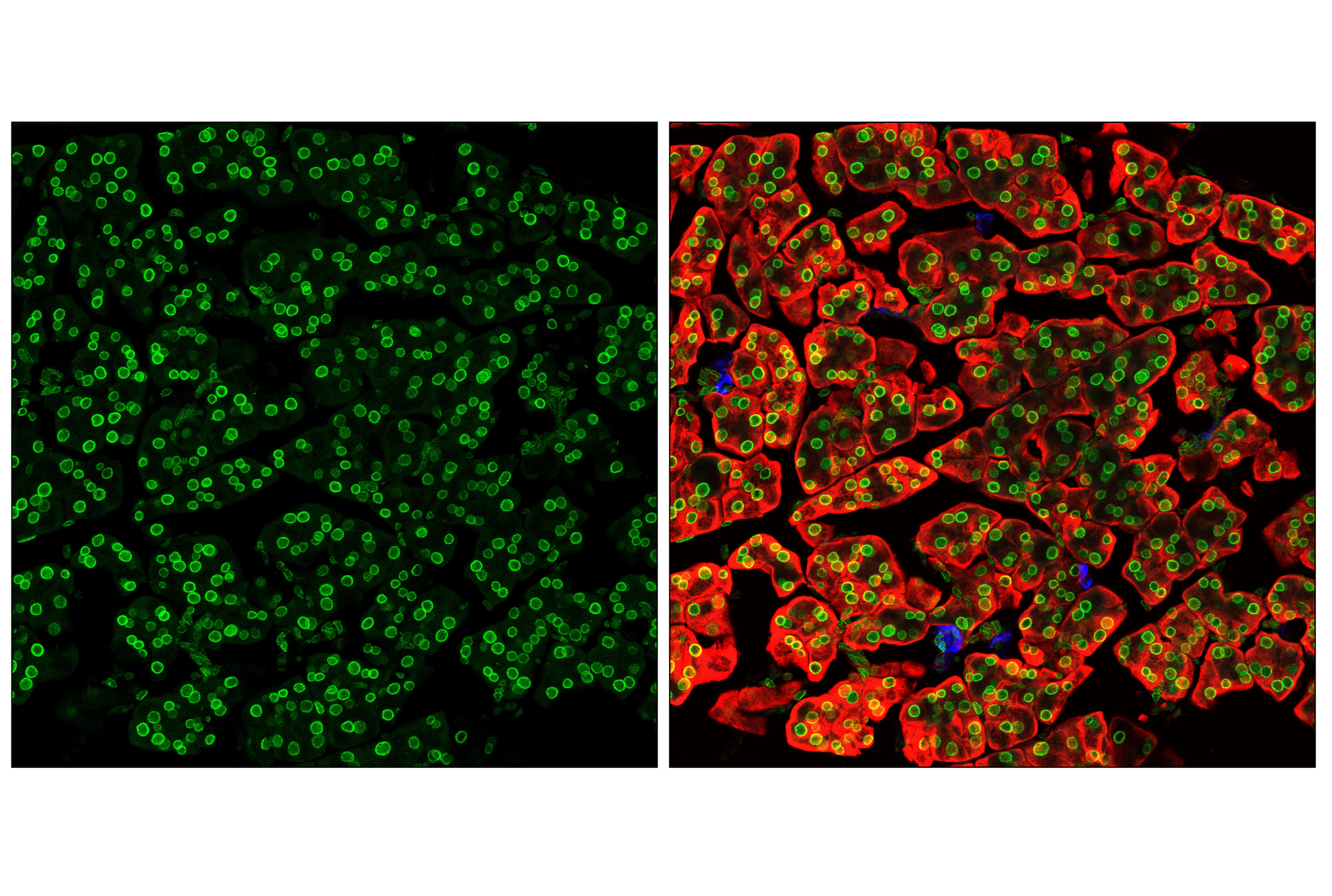 Immunofluorescence Image 2: NUP153 (E3N3Y) Rabbit mAb