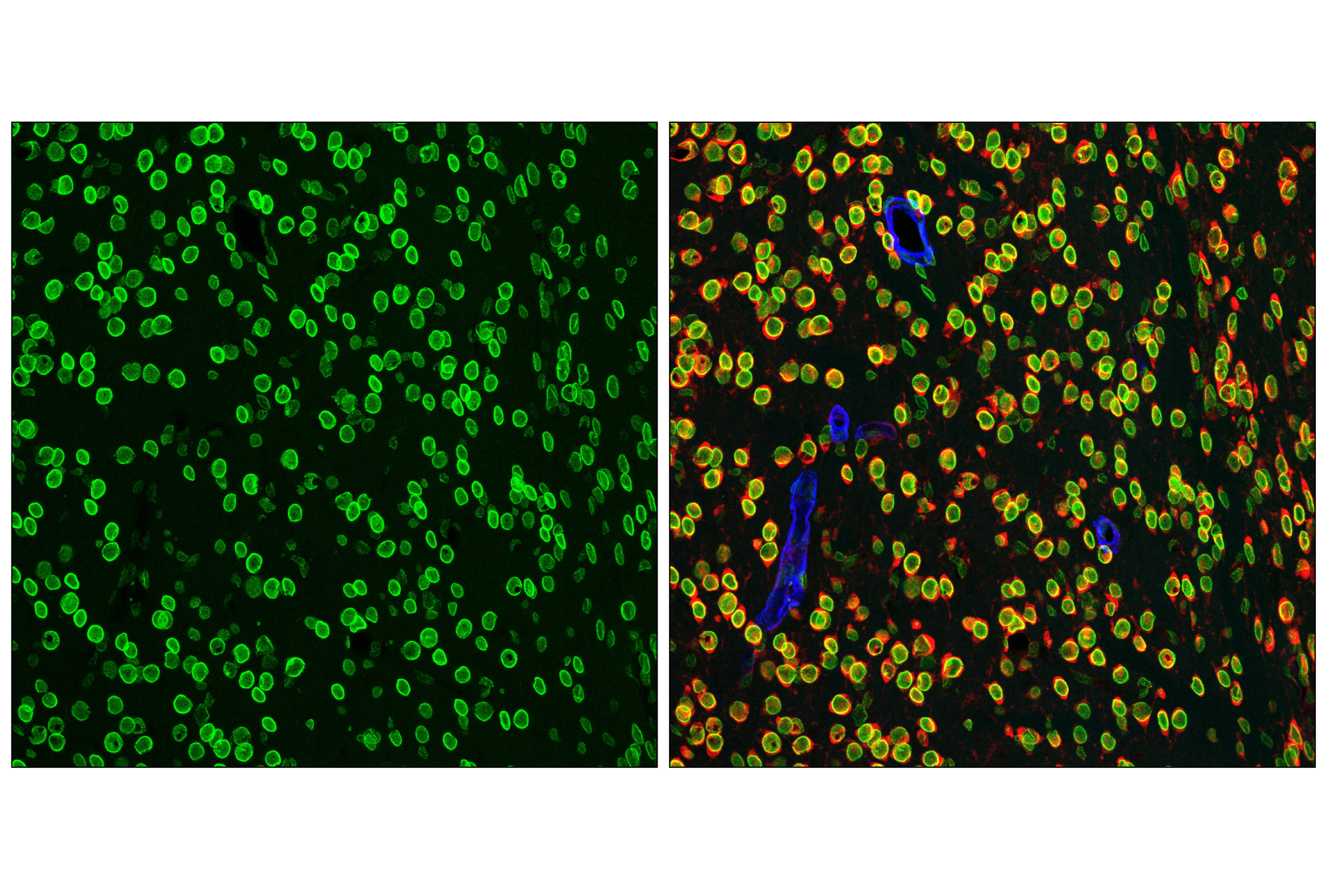 Immunofluorescence Image 3: NUP153 (E3N3Y) Rabbit mAb