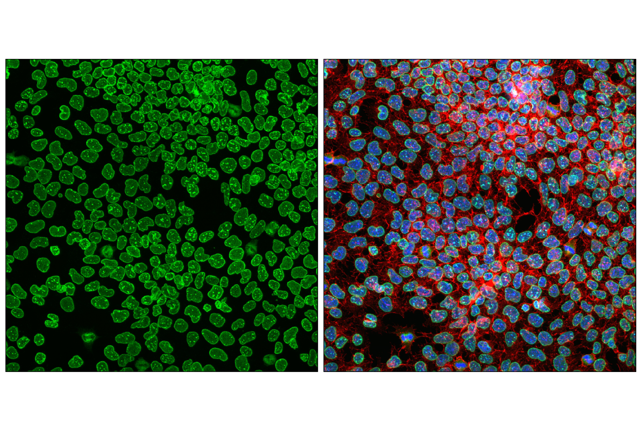 Immunofluorescence Image 4: NUP153 (E3N3Y) Rabbit mAb