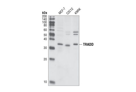 Western Blotting Image 1: TRADD Antibody