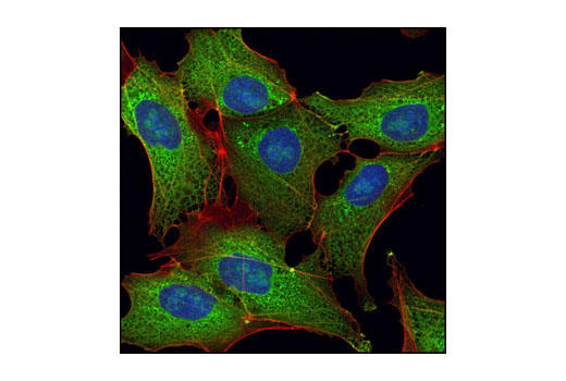 Immunofluorescence Image 1: LIN28A (D84C11) XP® Rabbit mAb