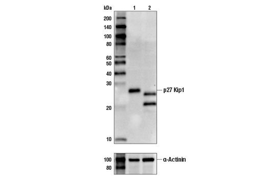  Image 7: Cyclin Dependent Kinase Inhibitor Antibody Sampler Kit