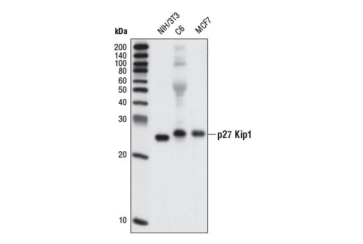  Image 14: Cyclin Dependent Kinase Inhibitor Antibody Sampler Kit