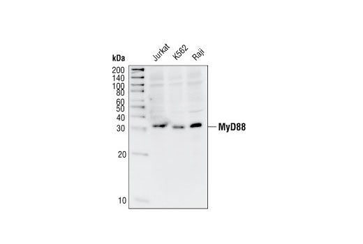 Western Blotting Image 2: MyD88 Antibody