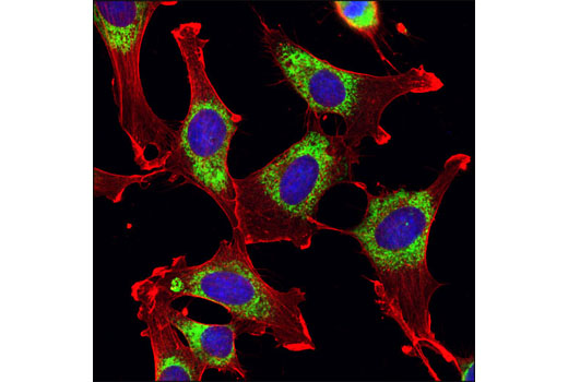 Immunofluorescence Image 1: β-Actin (8H10D10) Mouse mAb