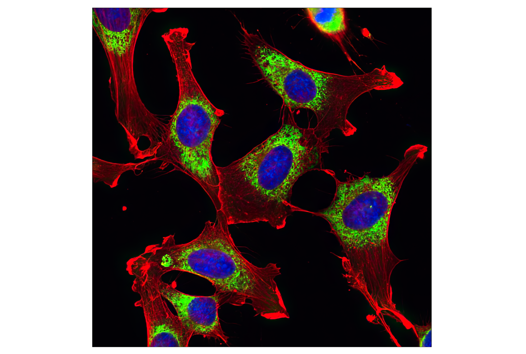 Immunofluorescence Image 1: β-Actin (8H10D10) Mouse mAb