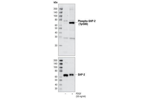  Image 2: SHP-2 Antibody Sampler Kit