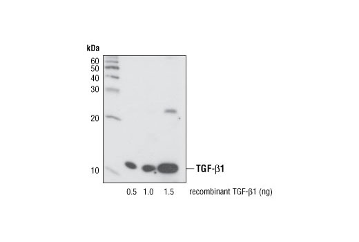  Image 3: Cancer-associated Growth Factor Antibody Sampler Kit