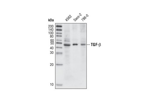  Image 22: TGF-β Fibrosis Pathway Antibody Sampler Kit
