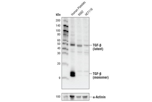 Western Blotting Image 1: TGF-β Antibody