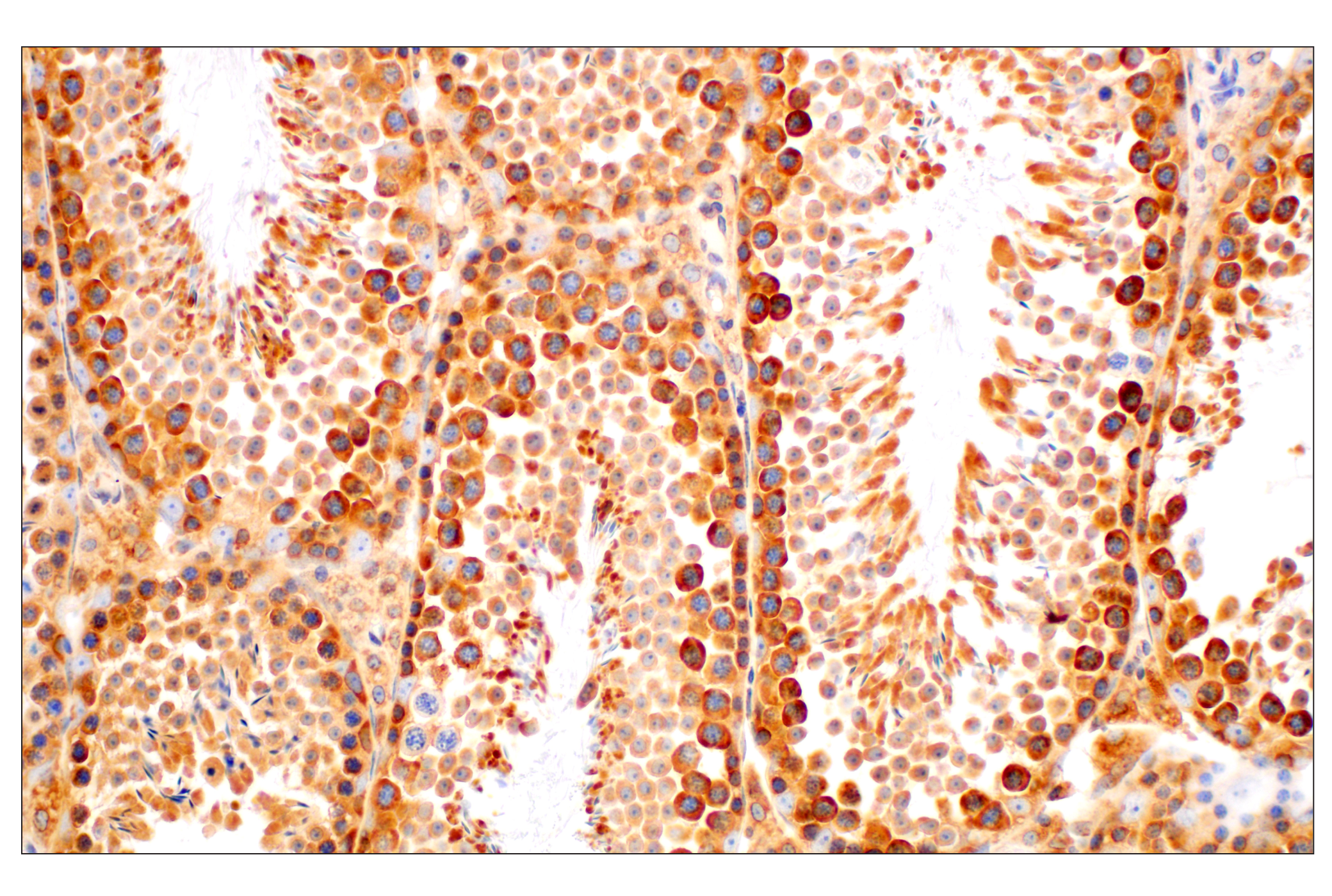 Immunohistochemistry Image 9: RACK1 (D59D5) Rabbit mAb (BSA and Azide Free)