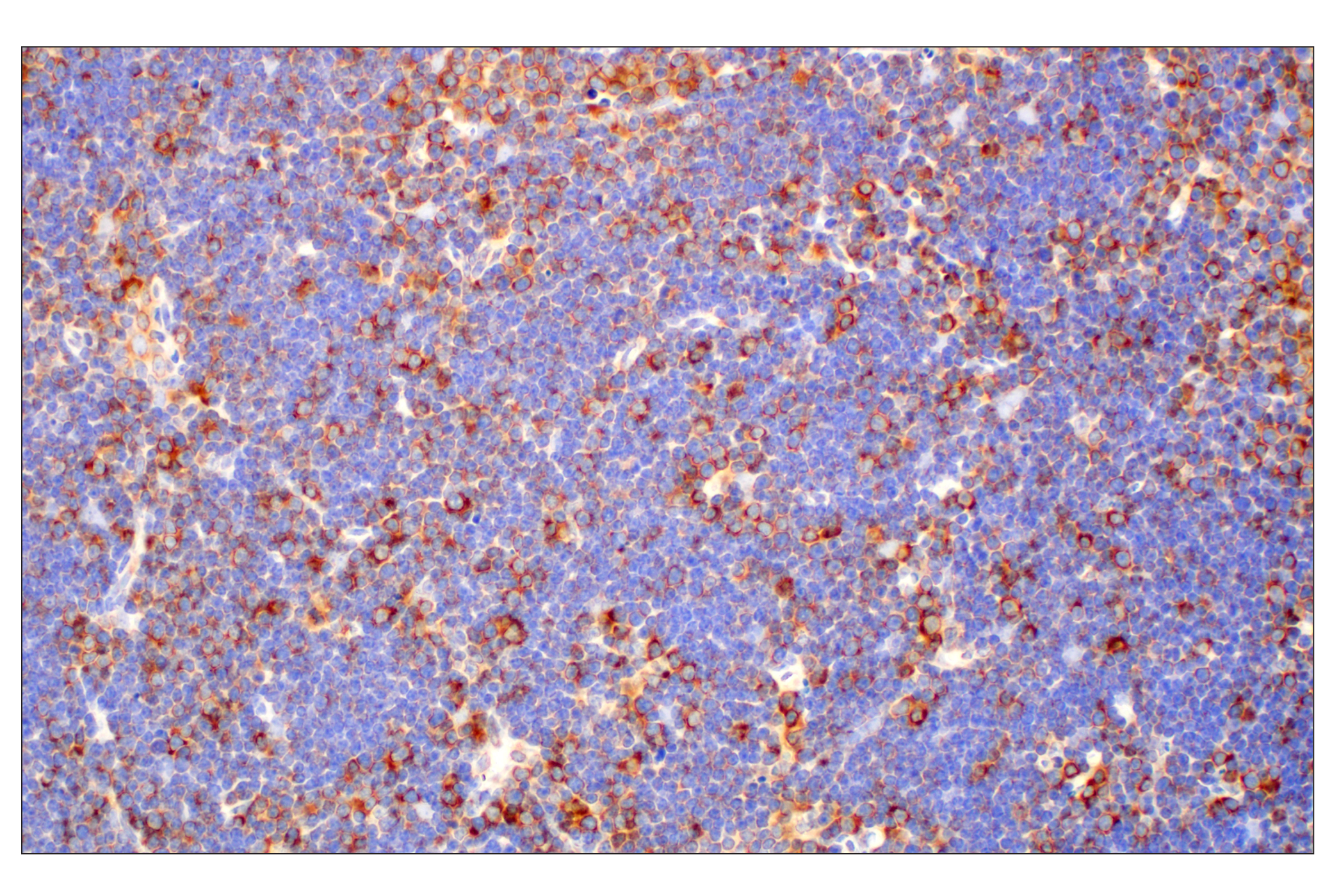 Immunohistochemistry Image 10: RACK1 (D59D5) Rabbit mAb (BSA and Azide Free)