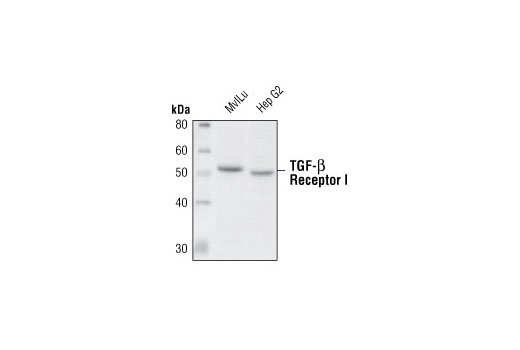 Western Blotting Image 1: TGF-β Receptor I Antibody