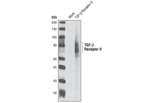 Western Blotting Image 1: TGF-β Receptor II (K105) Antibody