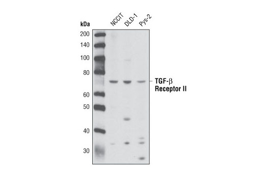 Western Blotting Image 2: TGF-β Receptor II (K105) Antibody