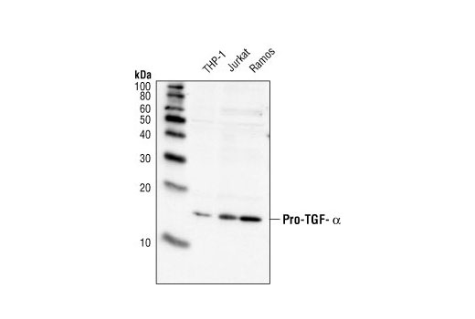 Western Blotting Image 1: Pro-TGF-alpha Antibody
