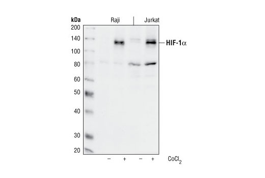 Western Blotting Image 1: HIF-1α Antibody