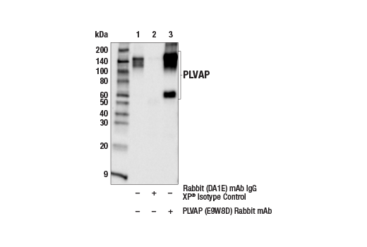 Immunoprecipitation Image 1: PLVAP (E9W8D) Rabbit mAb