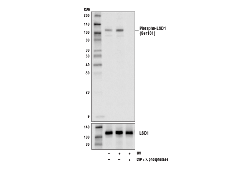 Western Blotting Image 1: Phospho-LSD1 (Ser131) Antibody