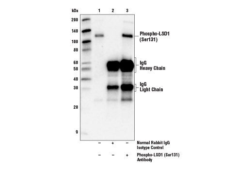Immunoprecipitation Image 1: Phospho-LSD1 (Ser131) Antibody