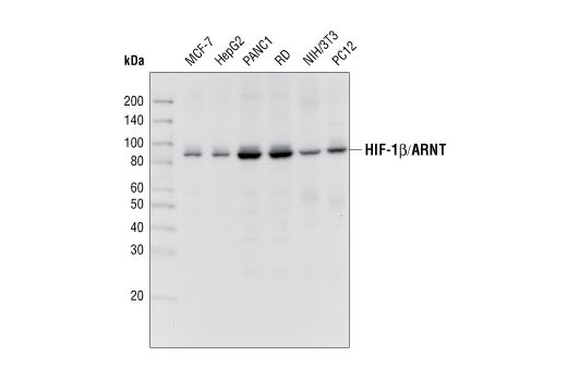 Western Blotting Image 1: HIF-1β/ARNT Antibody