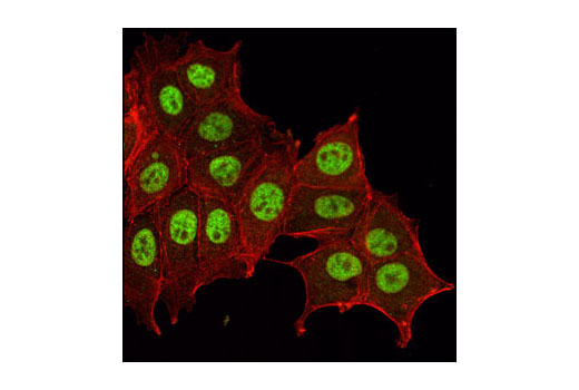 Immunofluorescence Image 1: HIF-1β/ARNT Antibody