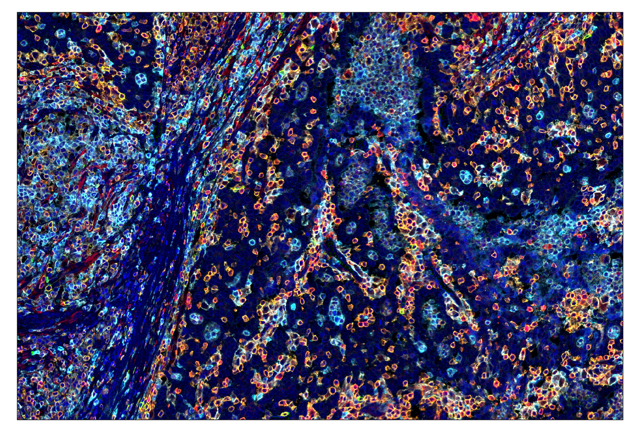 Immunohistochemistry Image 7: ICOS (D1K2T™) & CO-0027-647 SignalStar™ Oligo-Antibody Pair