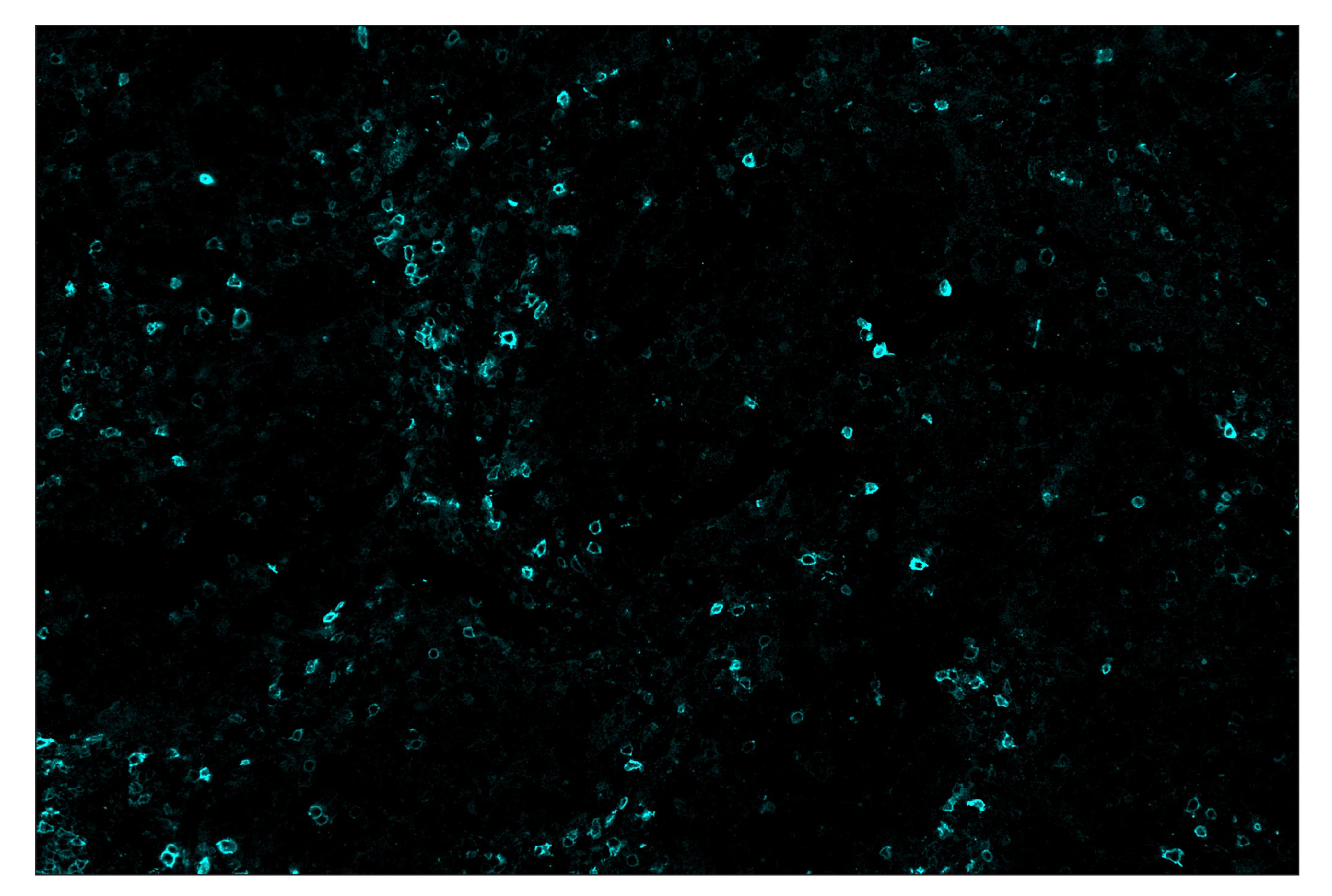 Immunohistochemistry Image 5: ICOS (D1K2T™) & CO-0027-647 SignalStar™ Oligo-Antibody Pair