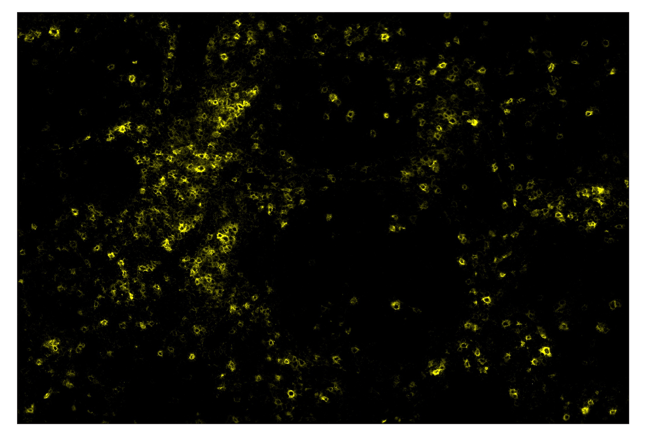 Immunohistochemistry Image 3: ICOS (D1K2T™) & CO-0027-488 SignalStar™ Oligo-Antibody Pair