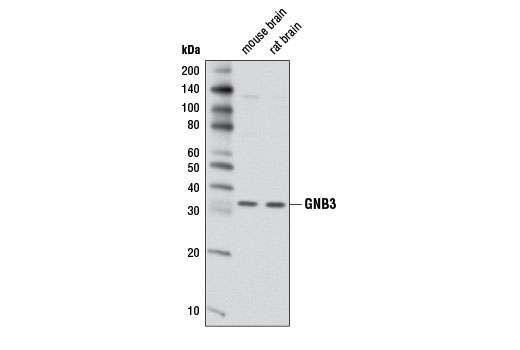 Western Blotting Image 1: GNB3 Antibody